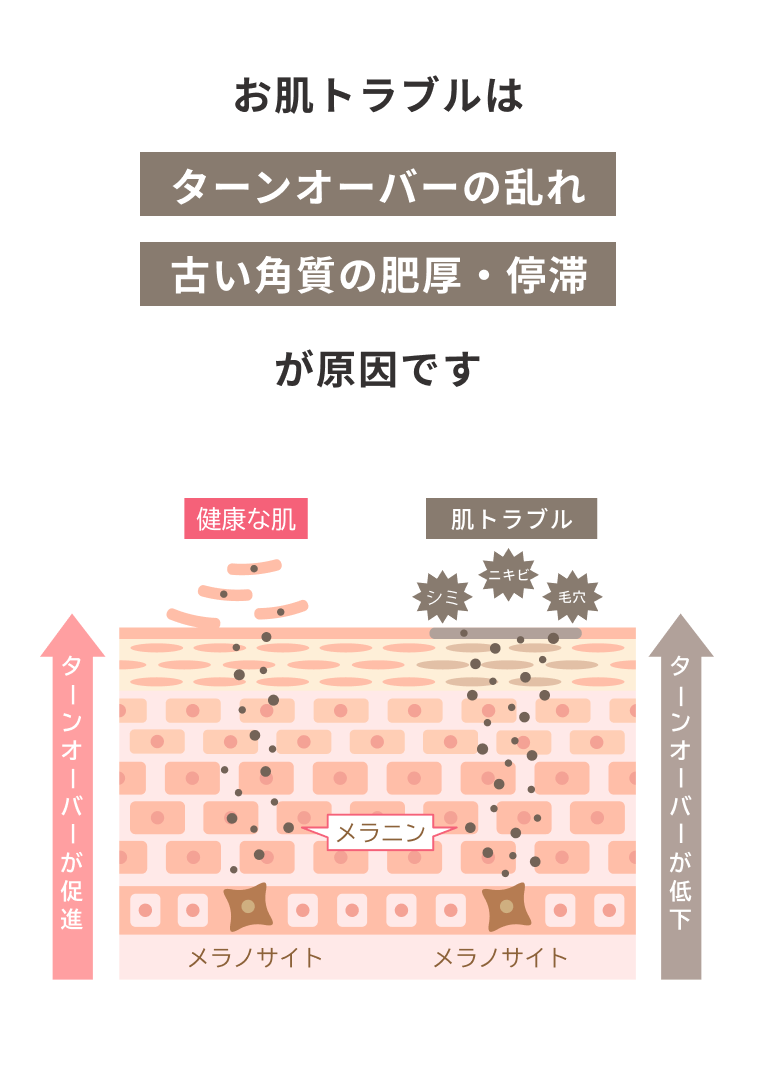 肌トラブルの原因